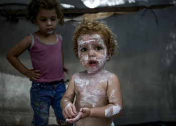 Palestinian children devastated by scabies, lice in Gaza tent camps