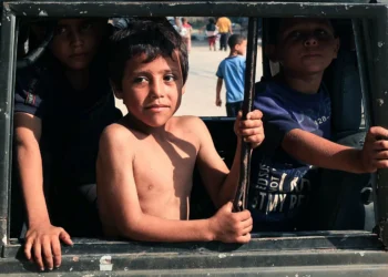 Israel’s war leaves Gazans, especially children, scarred for life