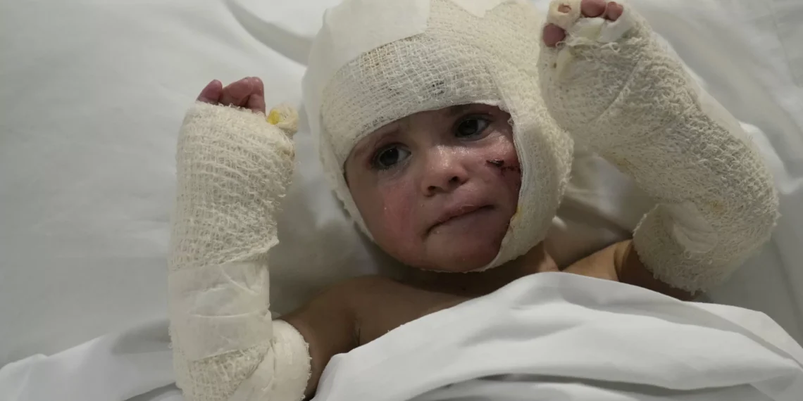 Israel’s war scars Lebanese children with physical, mental trauma