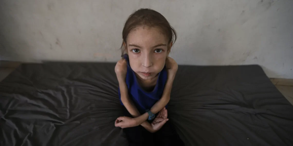Trapped Gaza girl fights undiagnosed illness sans medicine, hope