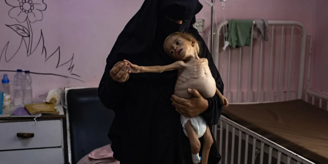 Starving children flood Gaza hospital as Netanyahu denies hunger