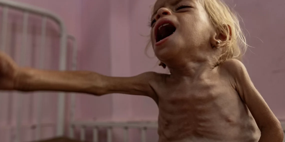 UN warns child malnutrition in Gaza has tripled since Israeli blockade