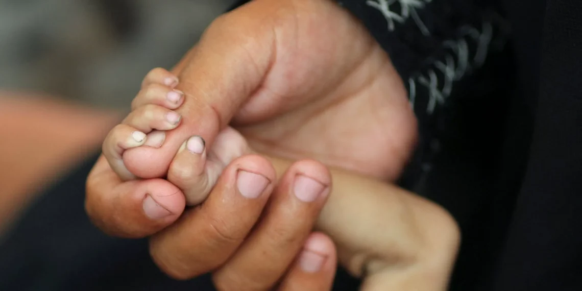 Gazan families in agony as malnutrition kills children, threatens more