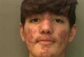 Teenage killer threw boiling water in prison officer’s face